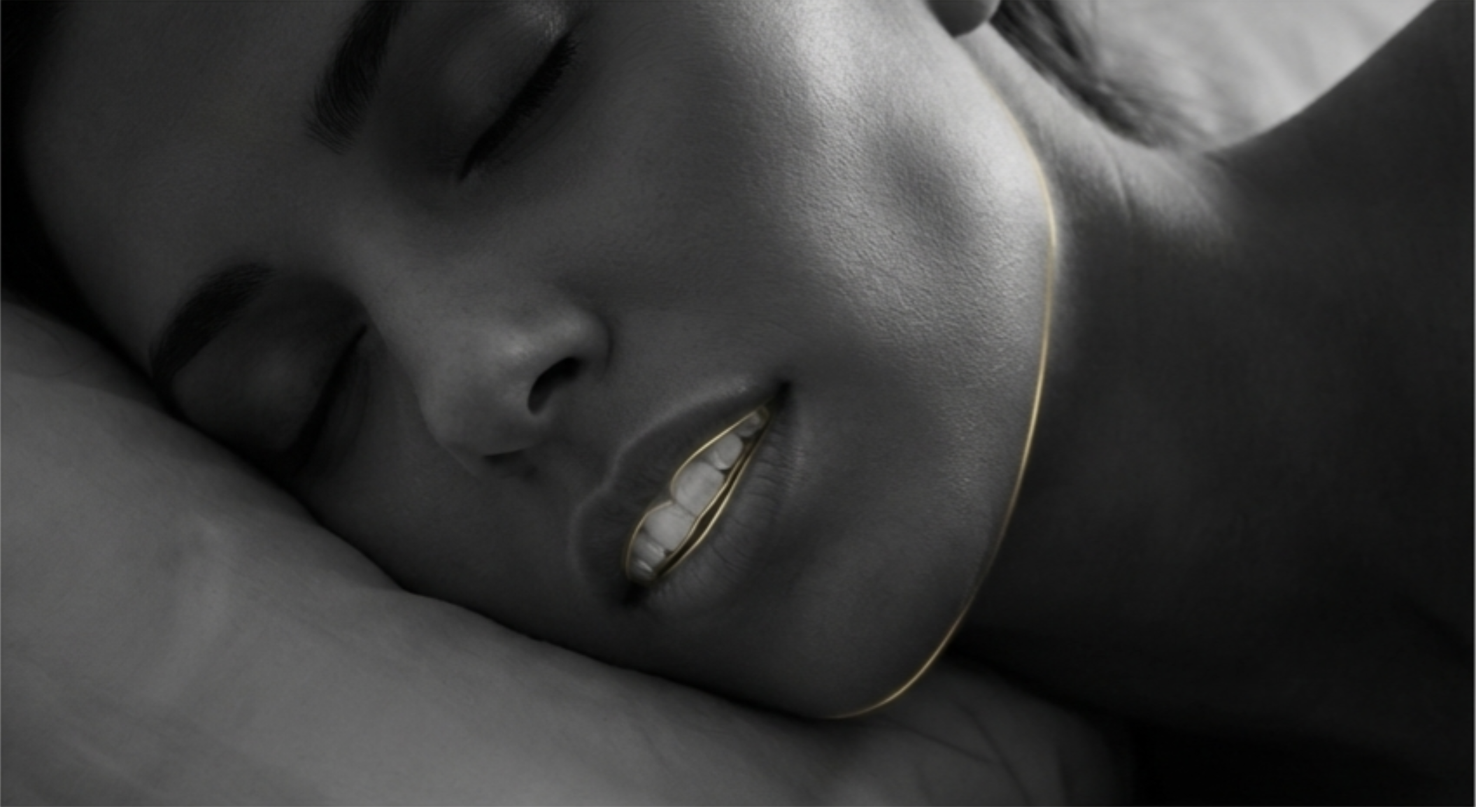 bruxism mouth guard worn at night for tooth protection