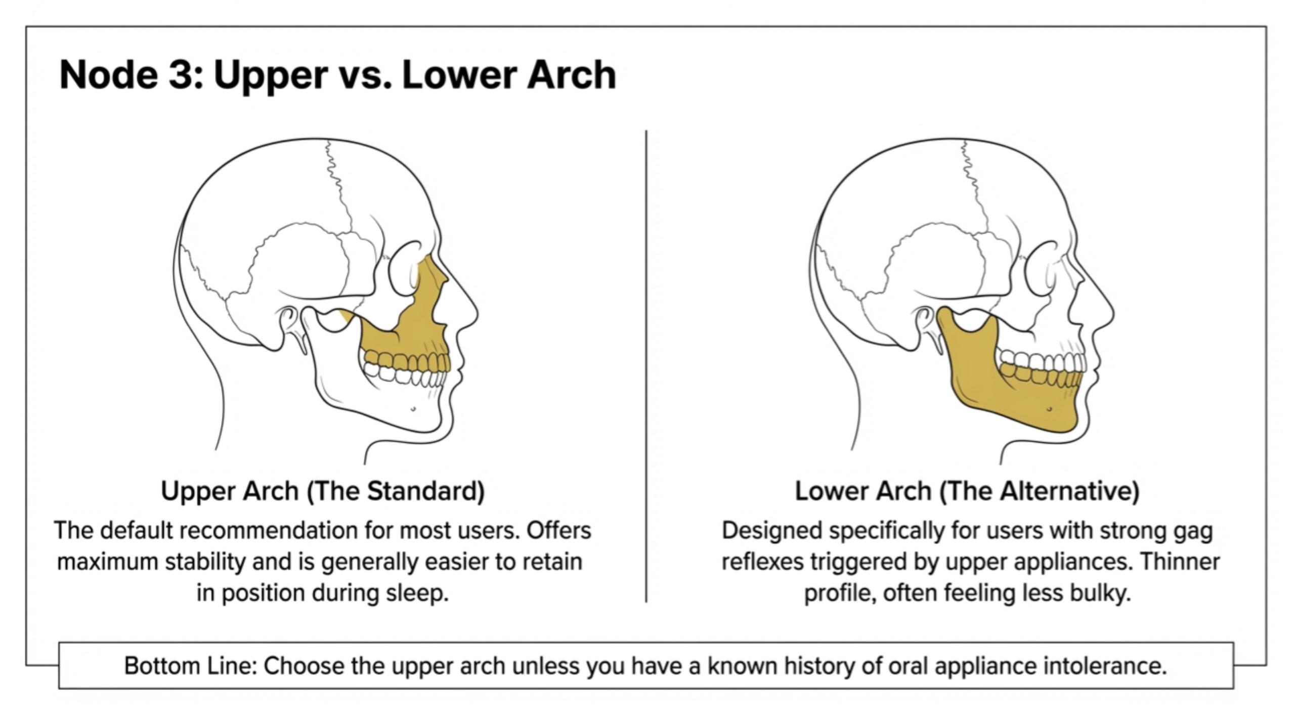 upper vs lower night guard arch comparison