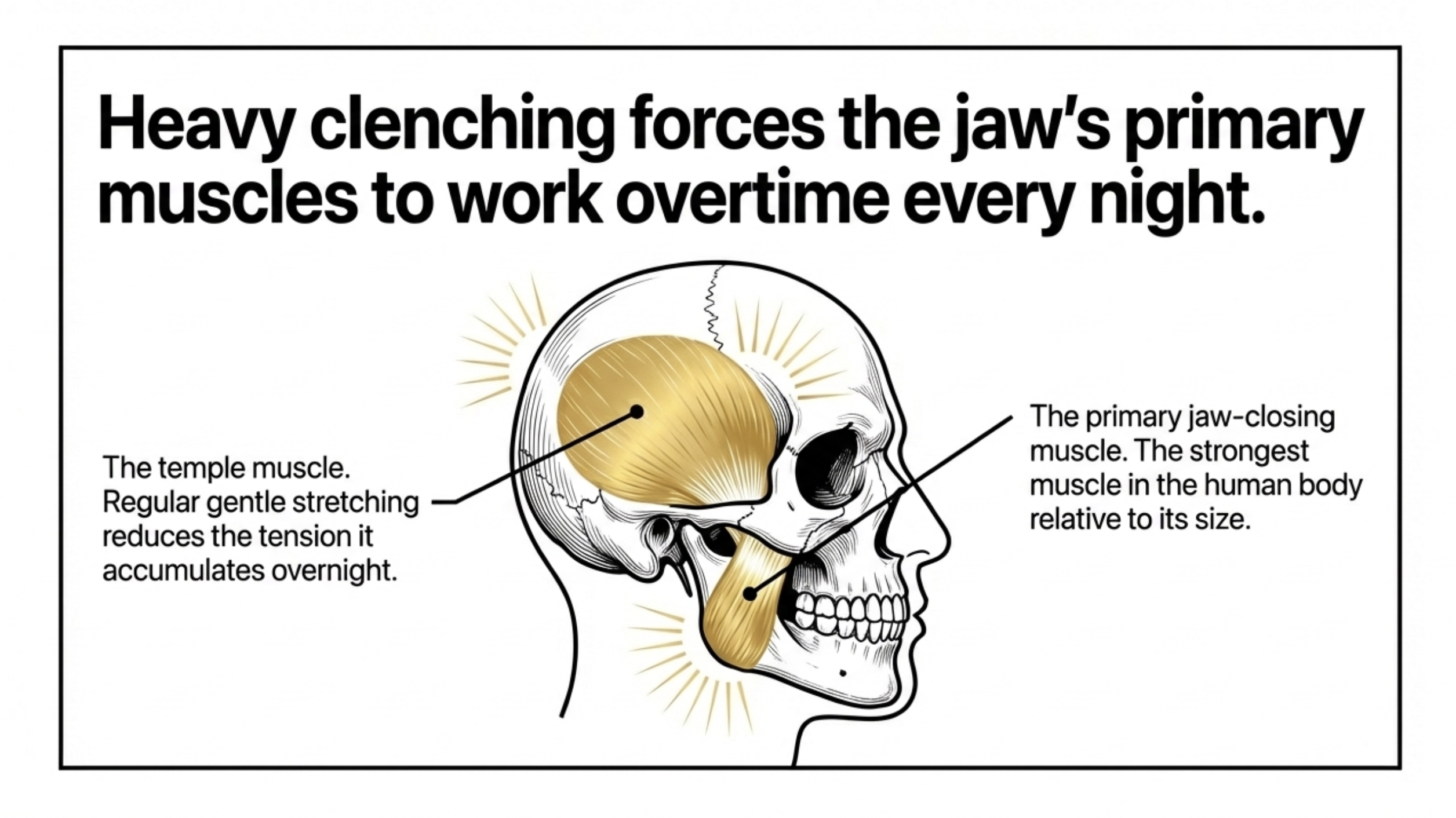 jaw muscles masseter and temporalis diagram bruxism tension