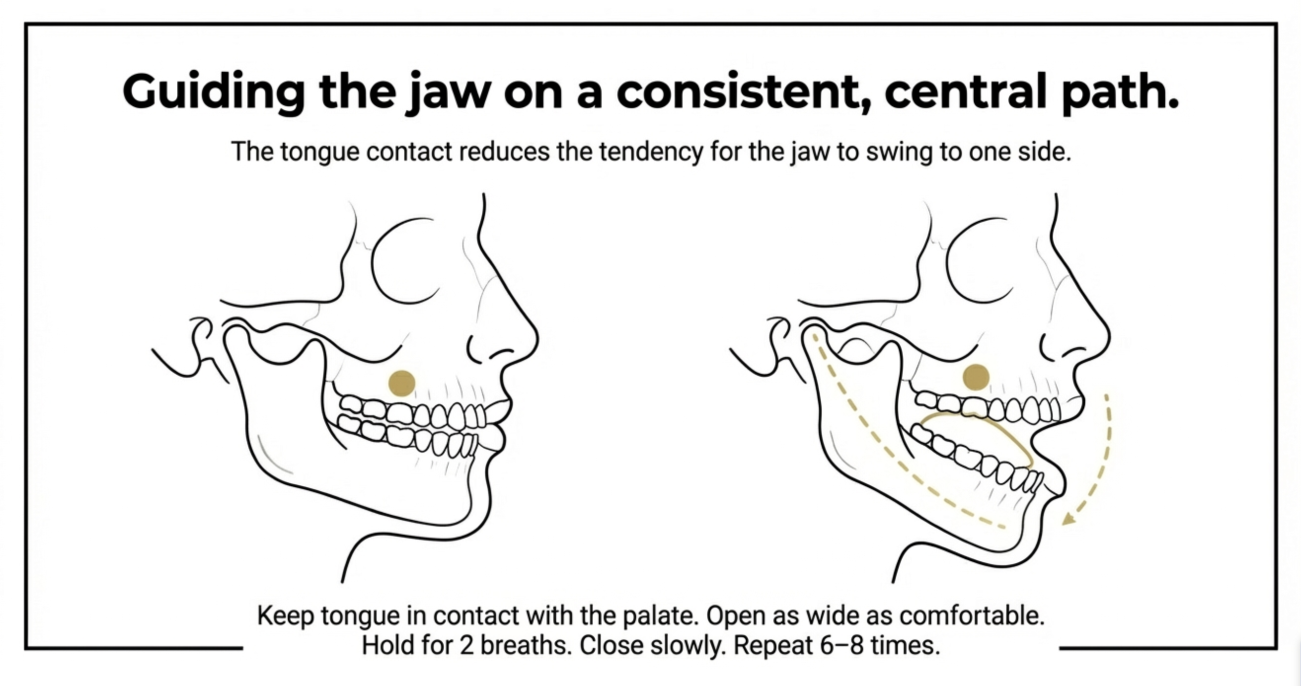 tongue to roof of mouth tmj jaw opening exercise steps
