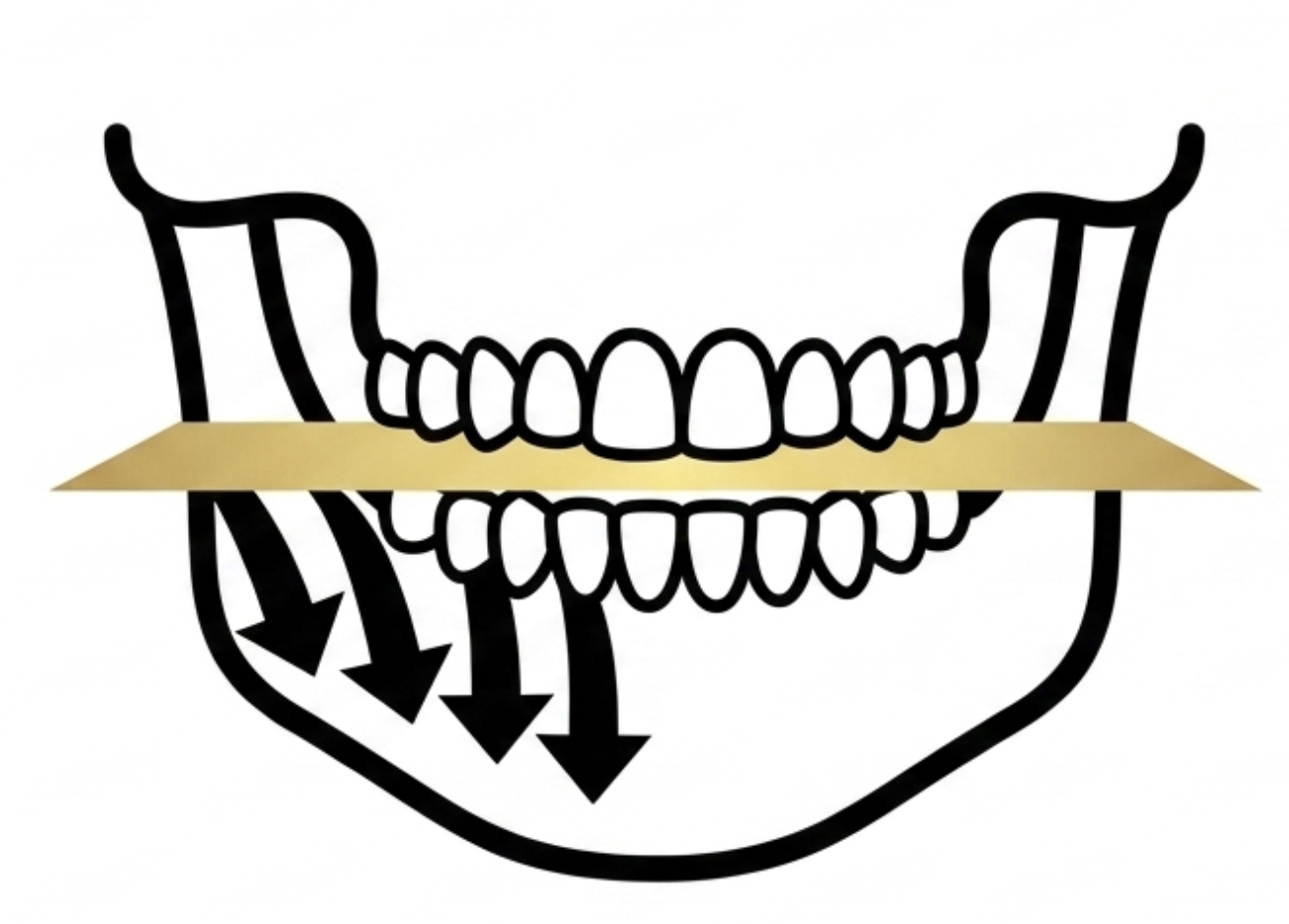 masseter muscle hypertrophy diagram bruxism lower face width