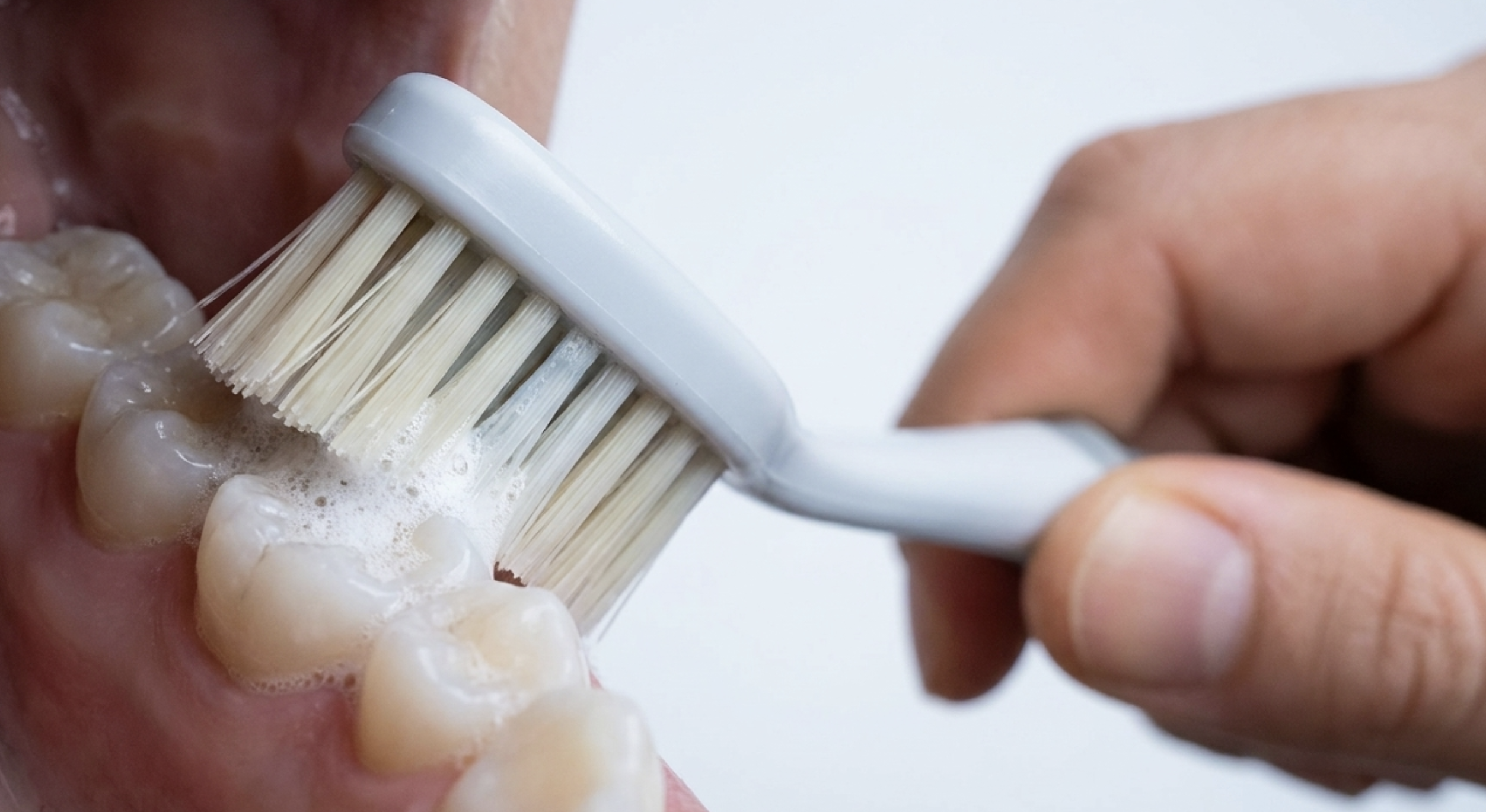 fluoride toothpaste remineralisation enamel protection GLP-1