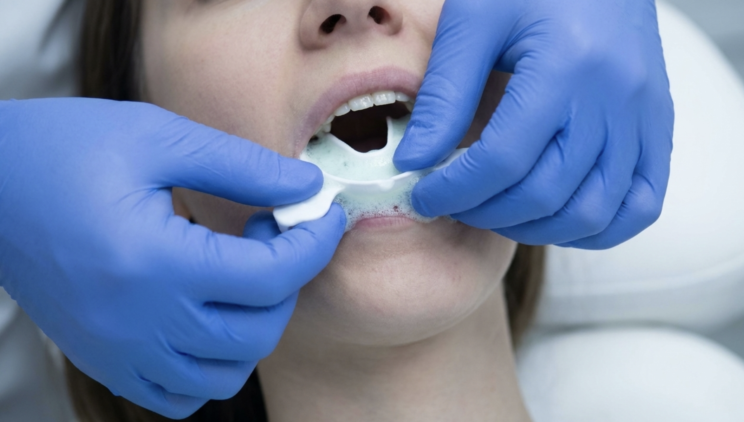 dentist visit dental checkup GLP-1 medication frequent monitoring